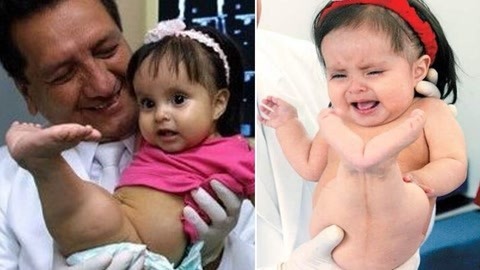 涨健识 萌宝双腿相连像一条美人鱼，真是太让人心疼了