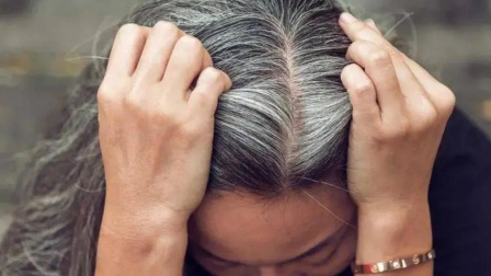 健康之路 白头发是什么原因导致的呢？看看你中招了吗