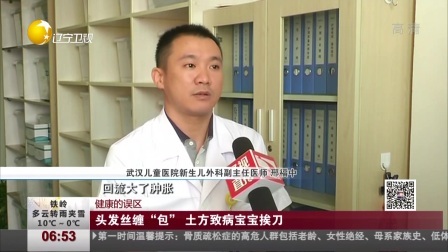 第一时间 以色列毛驴见到分别12年饲养员后一眼认出