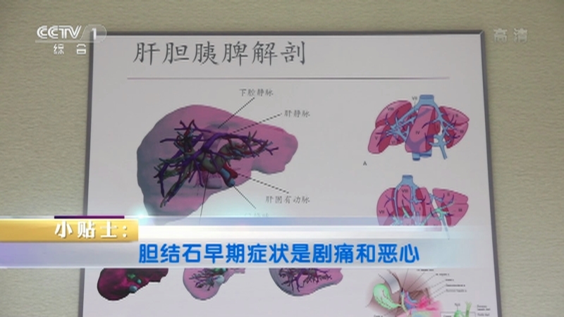 《生活提示》 20211120 天冷了 小心吃出胆结石