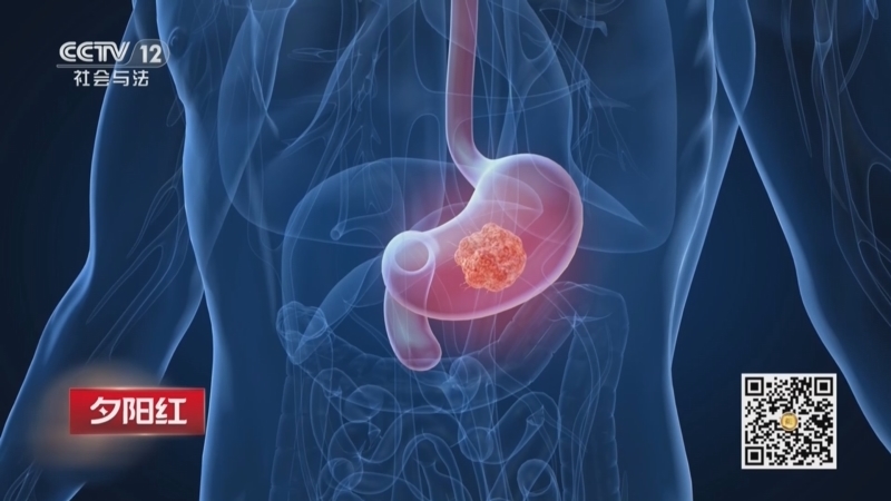 《夕阳红》 20260409 胃，你好吗？（2）