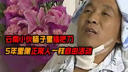 云南小伙脑子里插把刀，像正常人一样活了5年