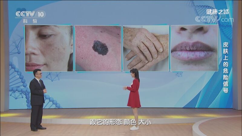 健康之路 《健康之路》 20201123 皮肤上的危险信号