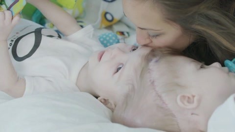 涨健识 可爱双胞胎共享一个大脑，妈妈心碎的吻让人太揪心