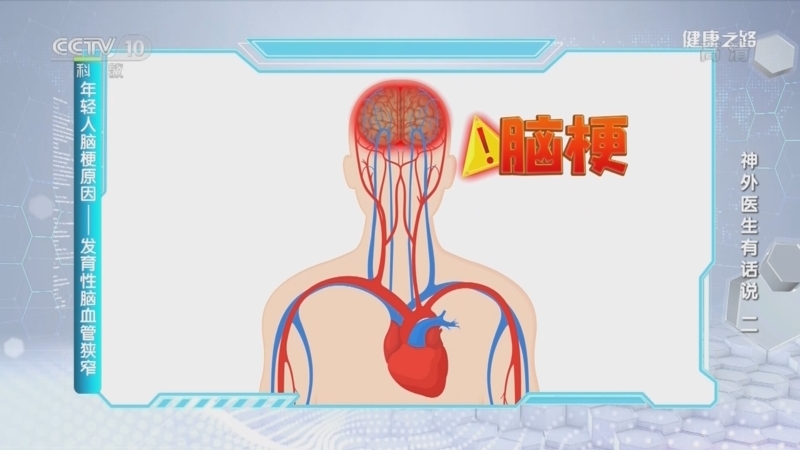 健康之路 《健康之路》 20221025 神外医生有话说（二）